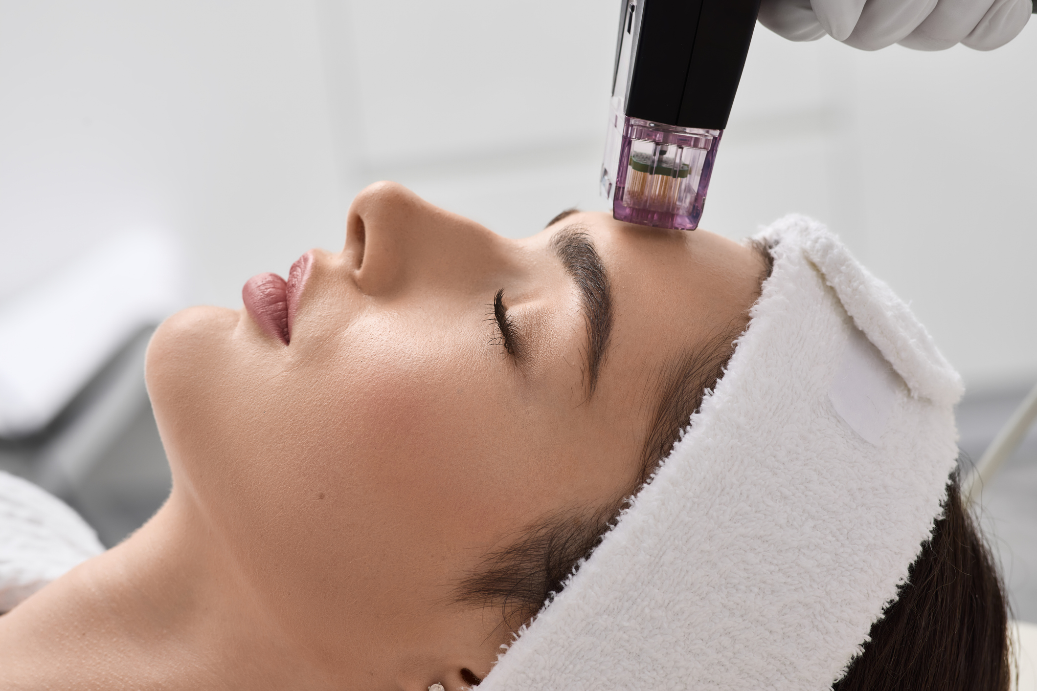 RF Microneedling Depth: Why Deeper is Not Always Better RF Microneedling Depth: Why Deeper is Not Always Better